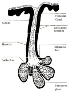 Sebaceous follicle