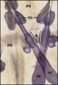 Sebum and sebaceous gland anatomy: SG: sebaceous gland, B: bulge region containing stem cells, HF: hair follicle, IFE: interfollicular epidermis