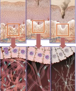 Aging skin