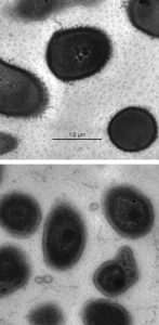 Transformation in bacterial structures under effect of resveratrol