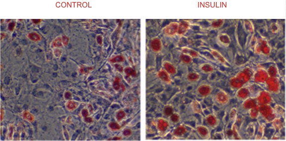 Insulin and sobocytes