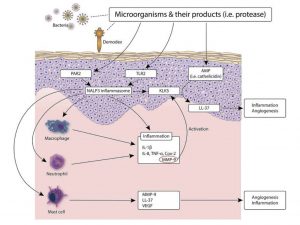 Bacteria implicated in acne rosacea, proposed mechanisms