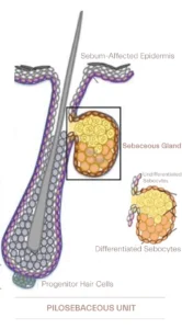 sebaceous follicle apparatus